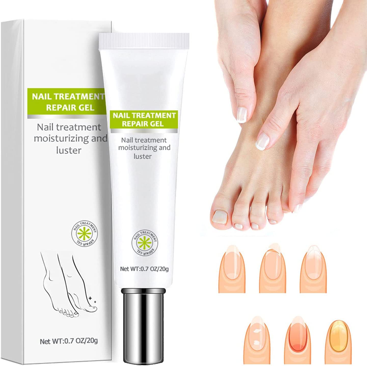 Nail Repair Gel